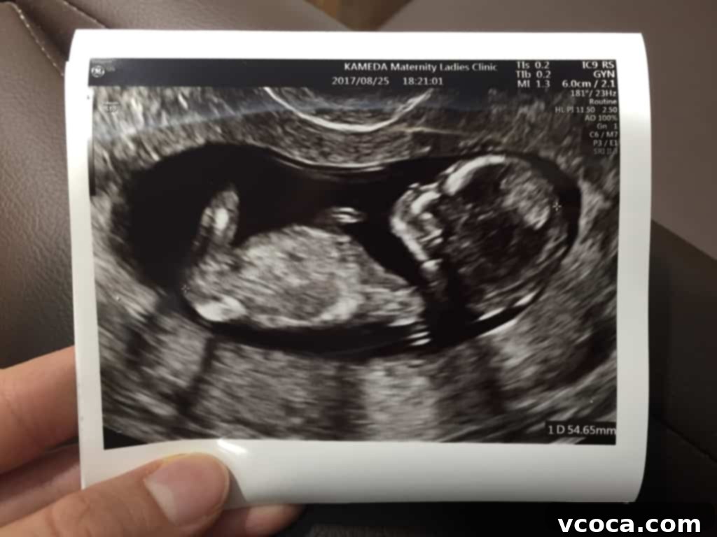 Our Koh Samui Honeymoon Delivered More Than Memories 2 Smiling woman gently holding her pregnant belly, hinting at a new chapter in her life.